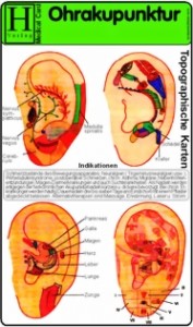Medizinische Karte A5: Ohrakupunktur 1507