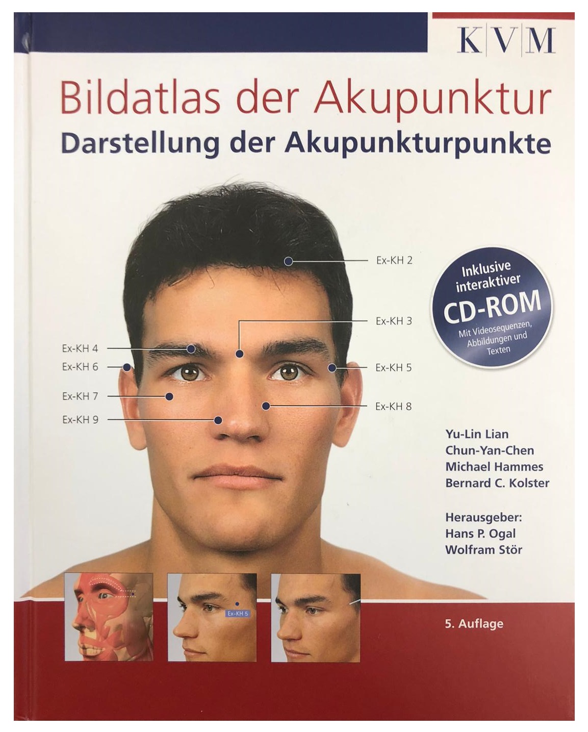 Bildatlas der Akupunktur - Darstellung der Akupunktur